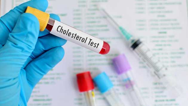 Nồng độ cholesterol trong máu