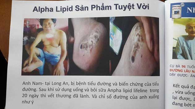 Nhân chứng sử dụng sữa non alpha lipid - Anh Nam.