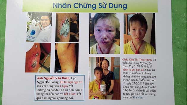 Nhân chứng sử dụng sữa non alpha lipid - anh Nguyễn Văn Duân và cháu Chu Thị Thu Hương.